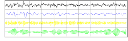 EEG brain waves Brain Training EEG brain waves