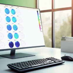 TQ8 Brain Map & Autoplan software